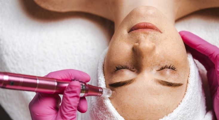 How Microneedling Plus Cupping May Help Your Skin